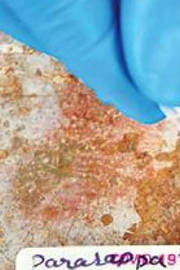 Recovered Covid patients may be immune to new virus strains Recovered Covid patients may be immune to new virus strains